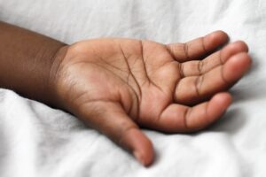 家庭用脱毛器は皮膚が乾燥している日にやめるべき？
